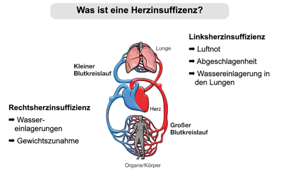 Krankheiten im Alter – Bild 3